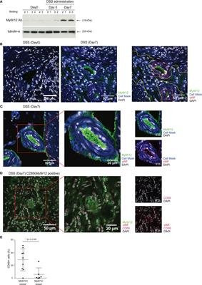 Myosin Light Chain 9/12 Regulates the Pathogenesis of Inflammatory Bowel Disease